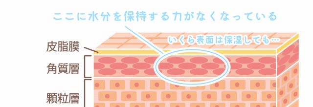 角層・角質層に水分を保持する力がなくなっている